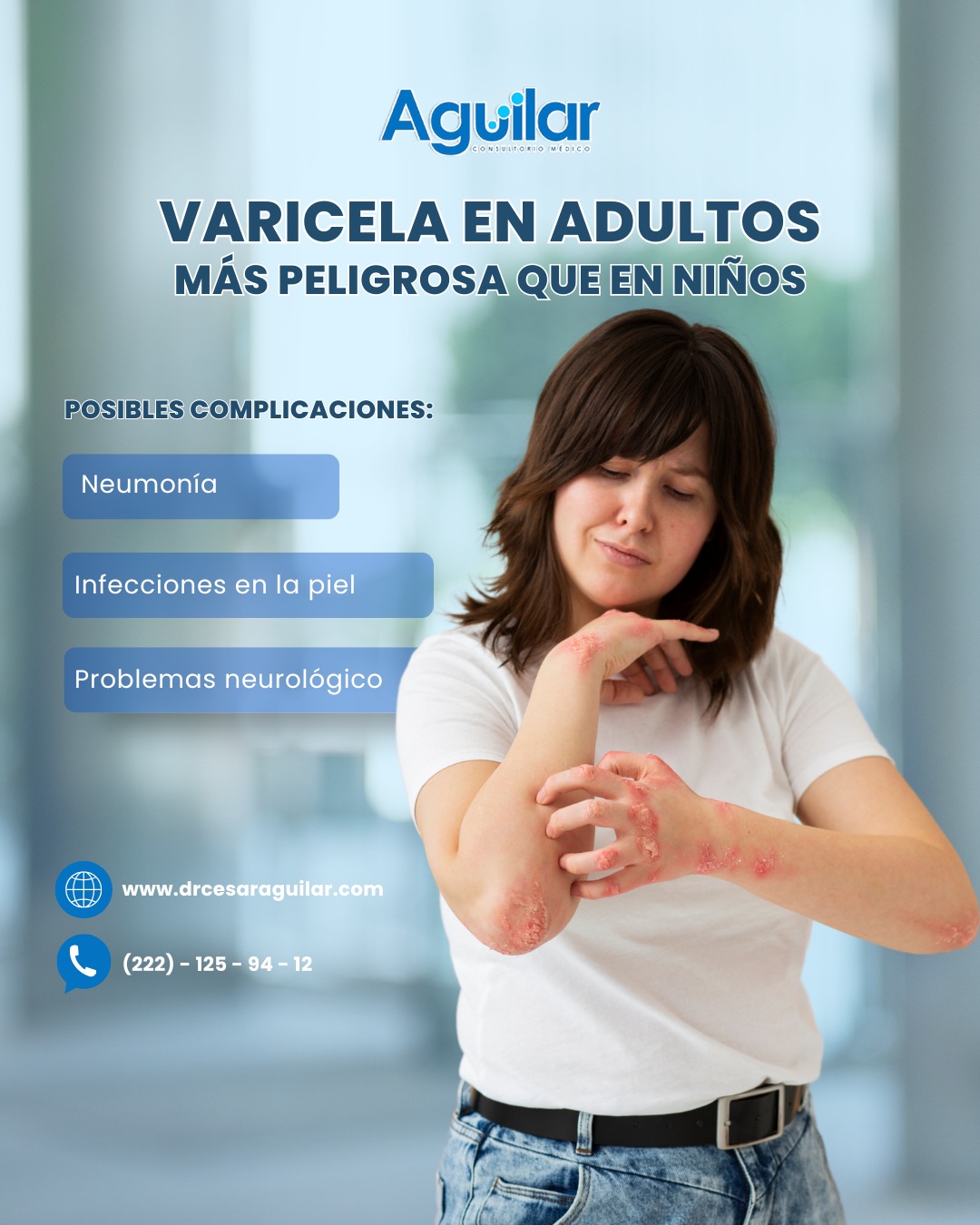 Varicela en adultos